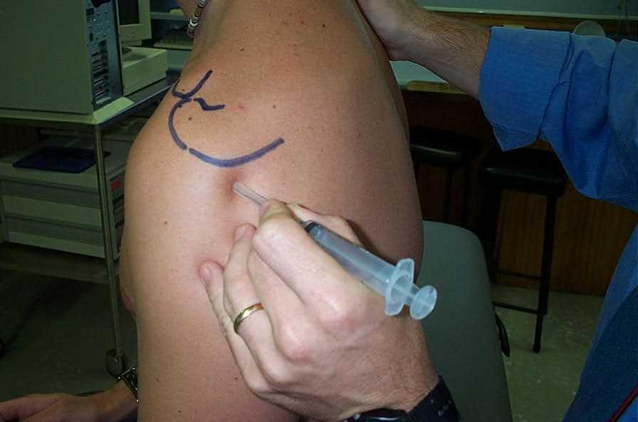 Hip Bursitis Treatment Cortisone Injection The Hip Flexor