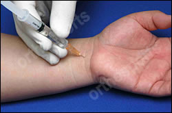 Steroid injection for carpal tunnel syndrome technique
