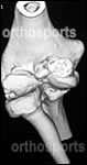 Elbow Joint